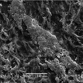 bakterii_280x280_crop_478b24840a